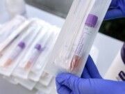 Sancionan a 16 laboratorios de pruebas Covid-19 en Q. Roo por operar con irregularidades