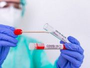Alertan de aumento de casos de Covid-19 en Bacalar; el único municipio al alza