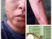 Protagoniza agresión regidora del PAN por disputa de propiedad en Lázaro Cárdenas